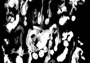 Lost Girls – Ruins